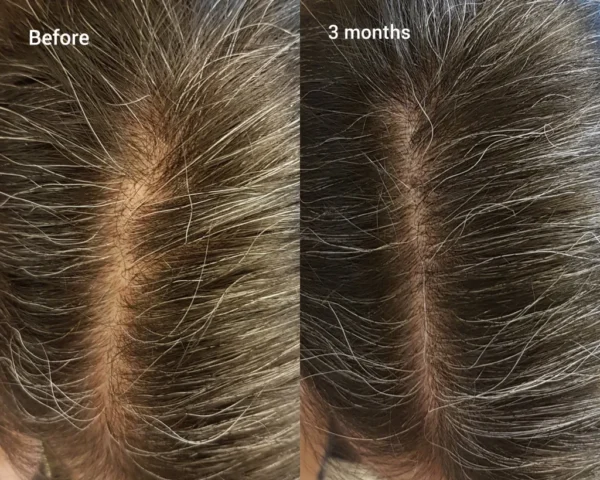 the ordinary multi-peptide serum for hair density